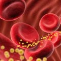 Кардиологи говорят, что добавление этого быстрого теста дает более четкую картину уровня холестерина