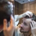 Исследование объясняет, почему некоторые мужчины рано теряют волосы